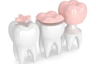 EKS-Endo Motor EKS-Endo Motor